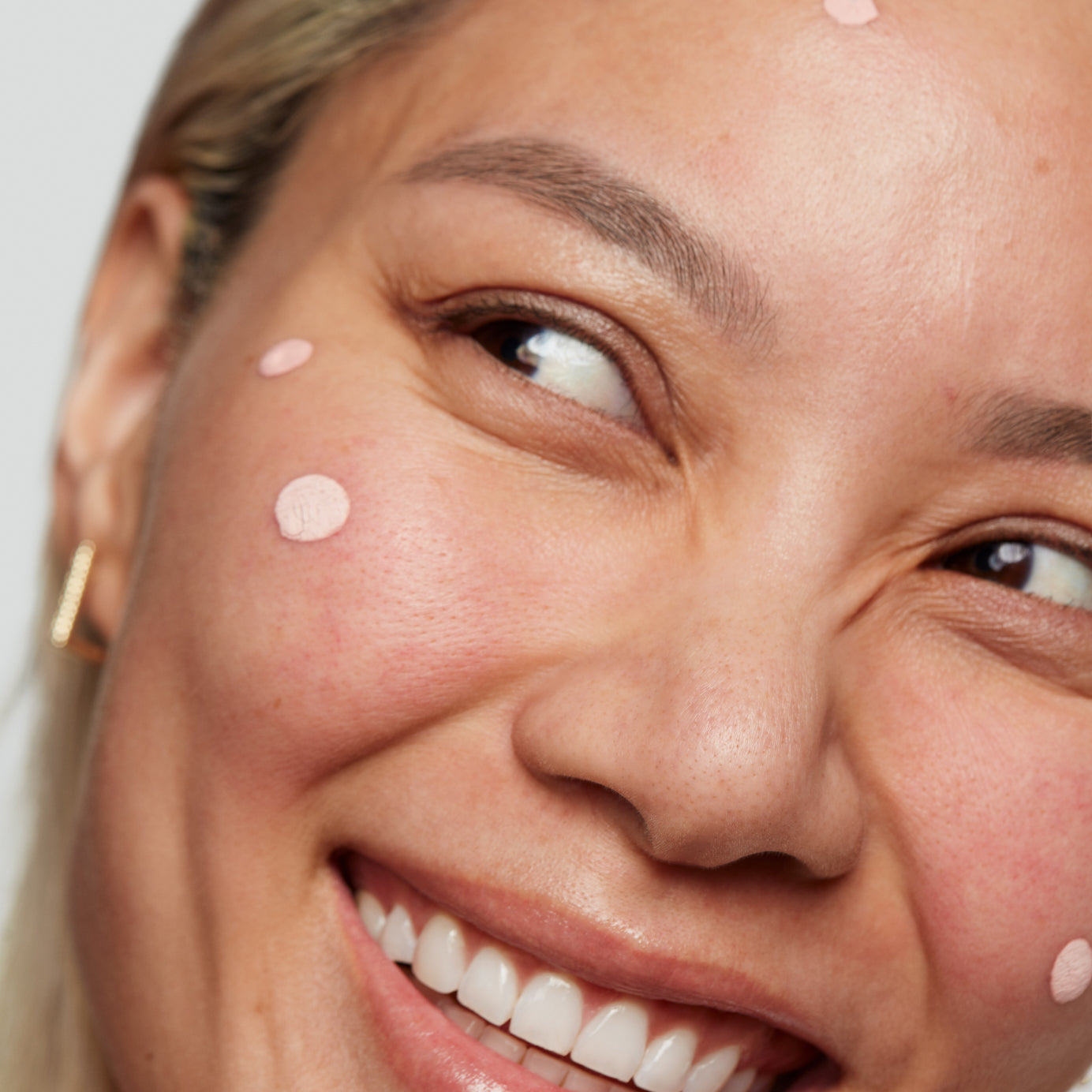 EradiKate® 10% Sulfur Acne Treatment