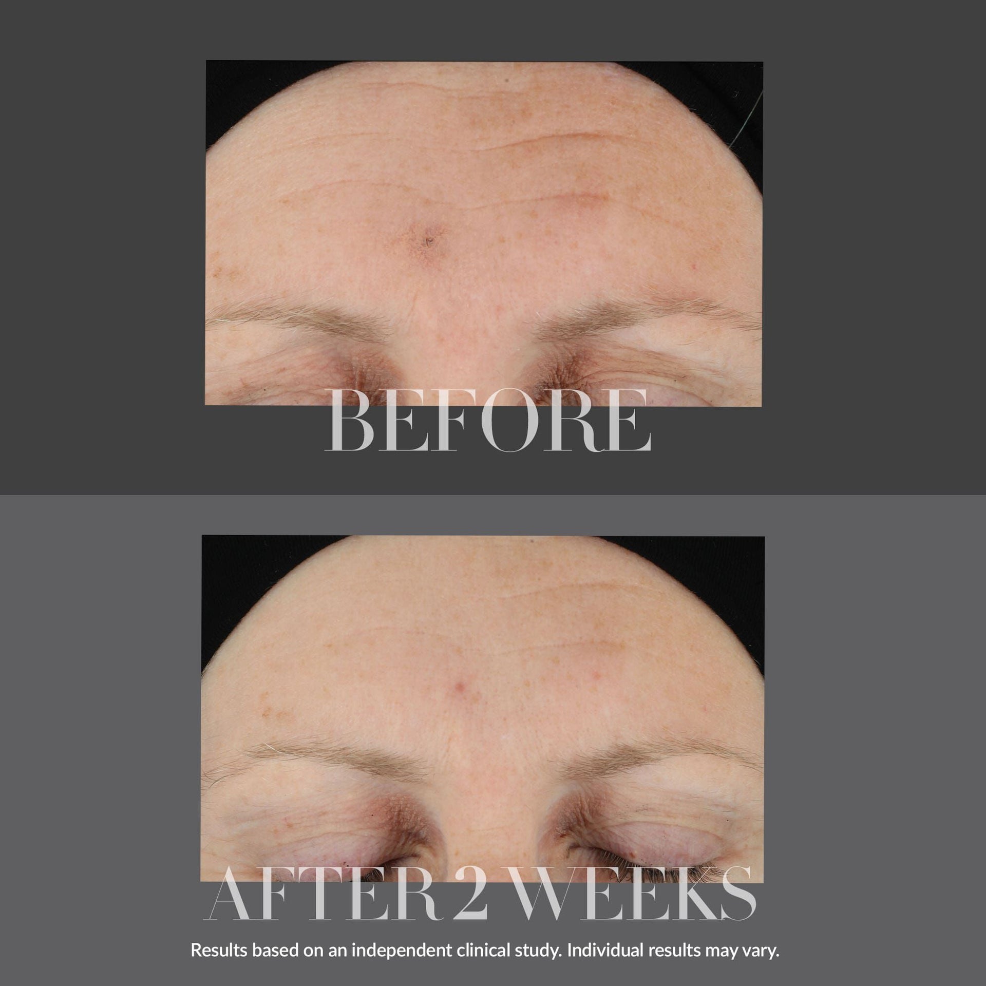 KateCeuticals™ Firming Serum