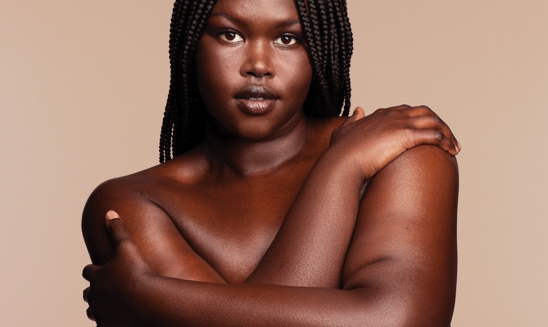 ECZEMA VS DERMATITIS