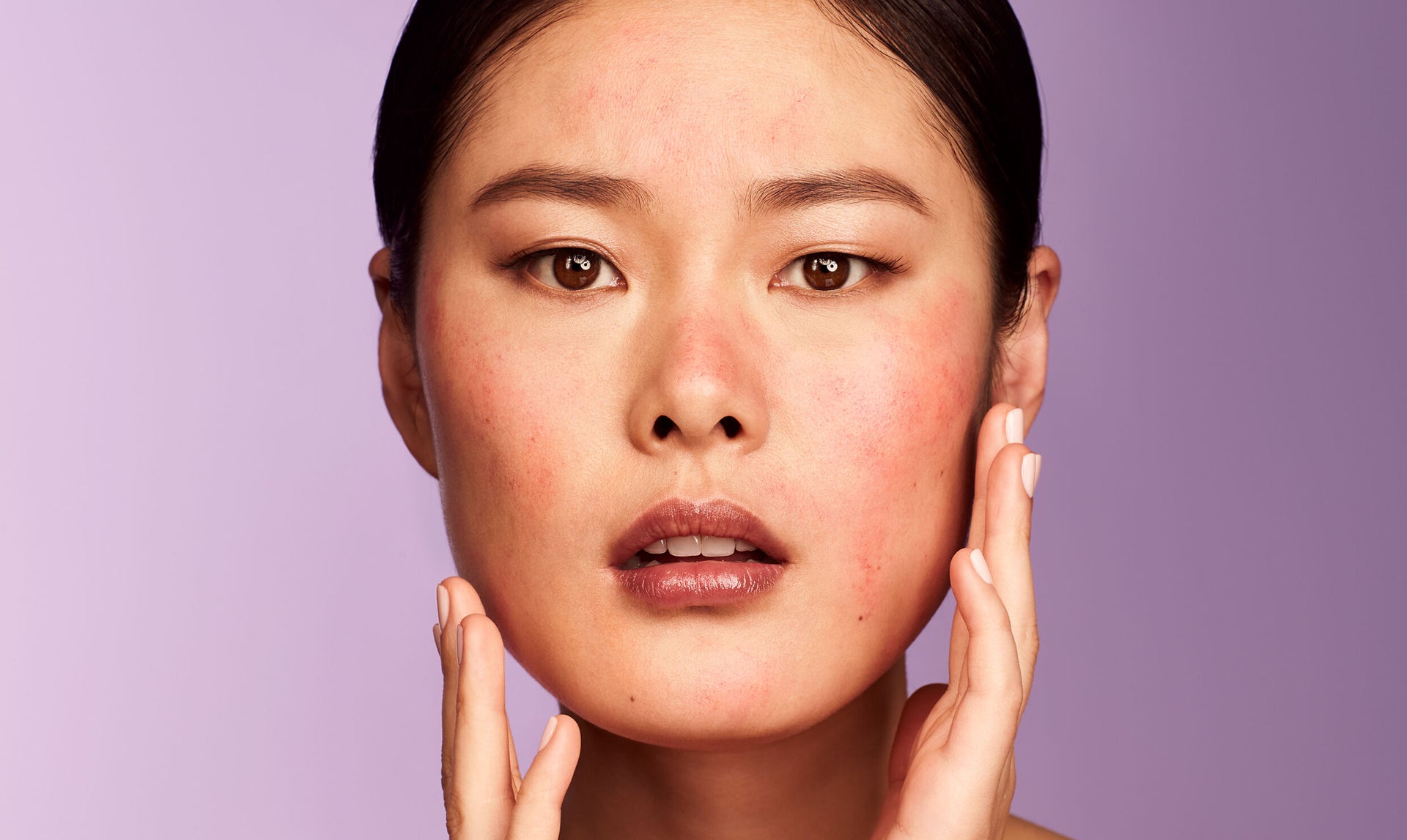 4 REMEDIES GOOD FOR HELPING SUNBURN