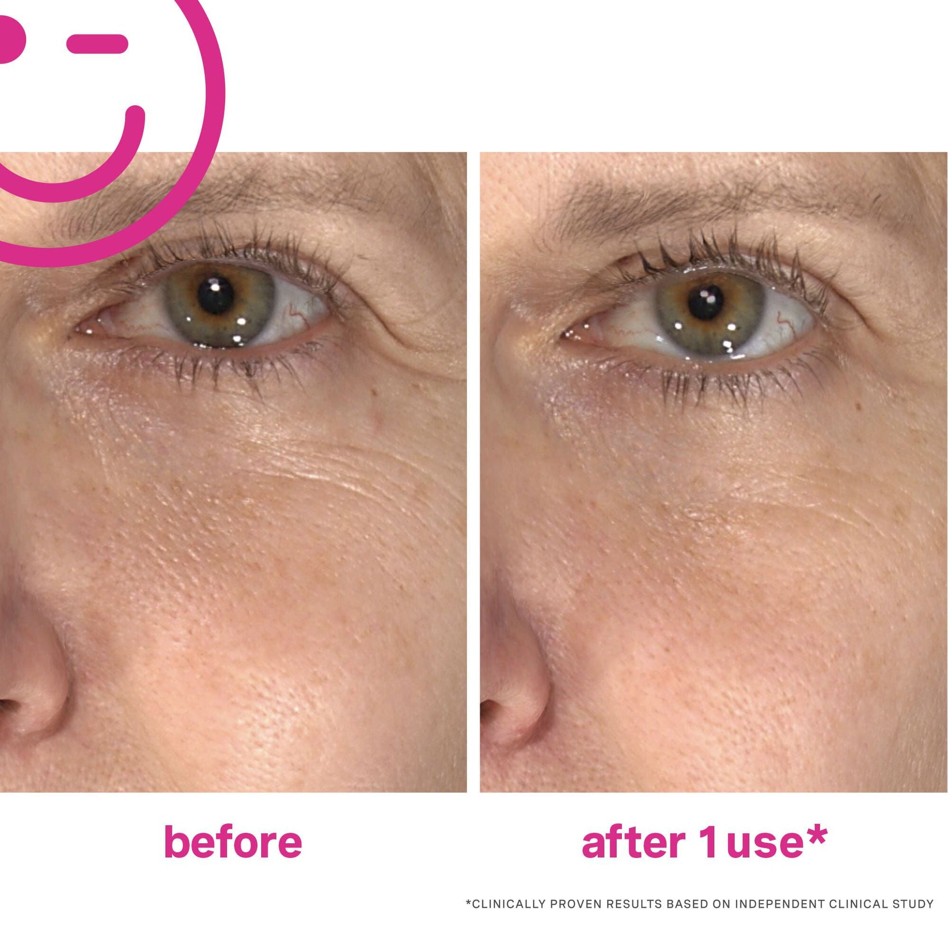 Wrinkle Warrior® 2-in-1 Plumping Moisturizer + Serum