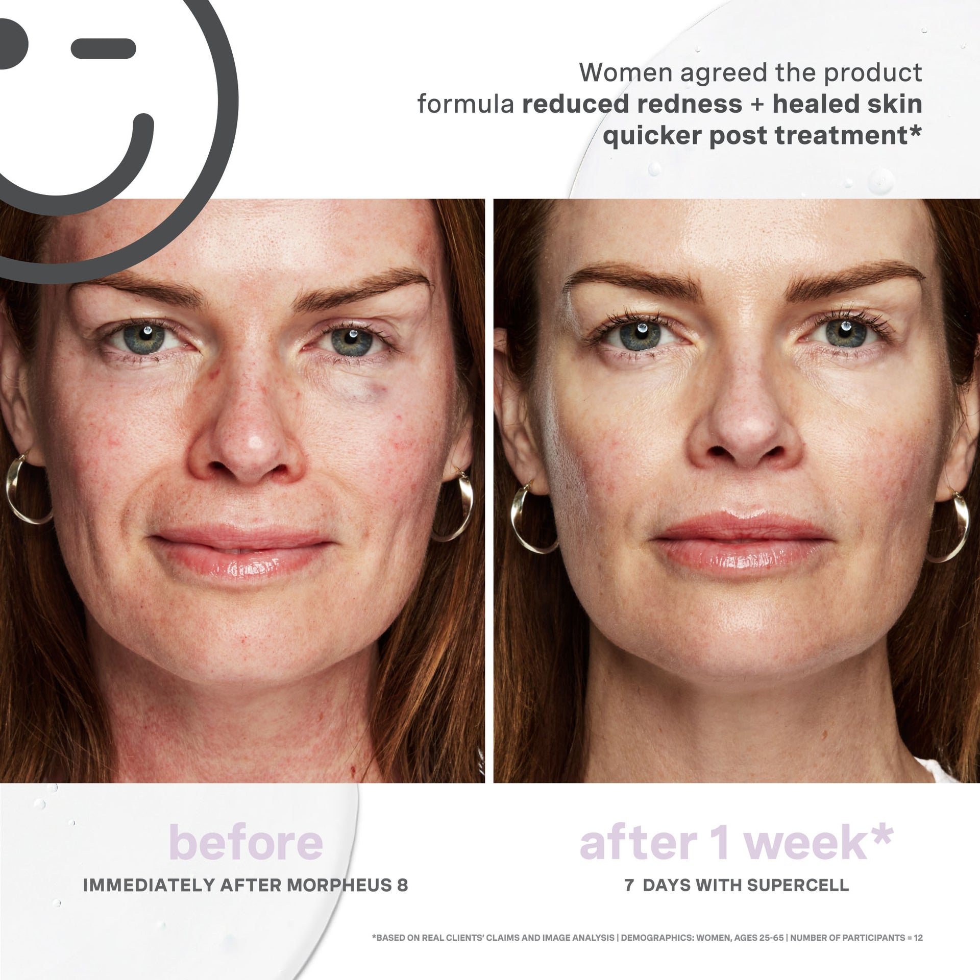 KateCeuticals SuperCell Rejuvenation Serum